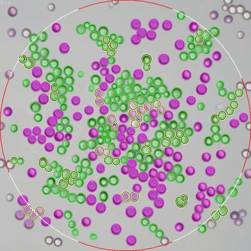 Oculyze cell counter: counting yeast cells after