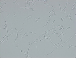 Microscopic image of used strain