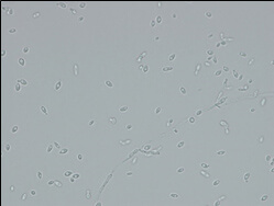 Microscopic image of used strain