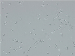 Microscopic image of used strain