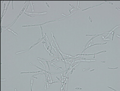 Microscopic image of used strain