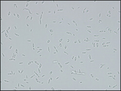 Microscopic image of used strain