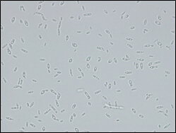 Microscopic image of used strain