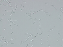 Microscopic image of used strain