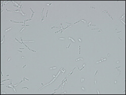 Microscopic image of used strain