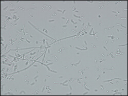 Microscopic image of used strain