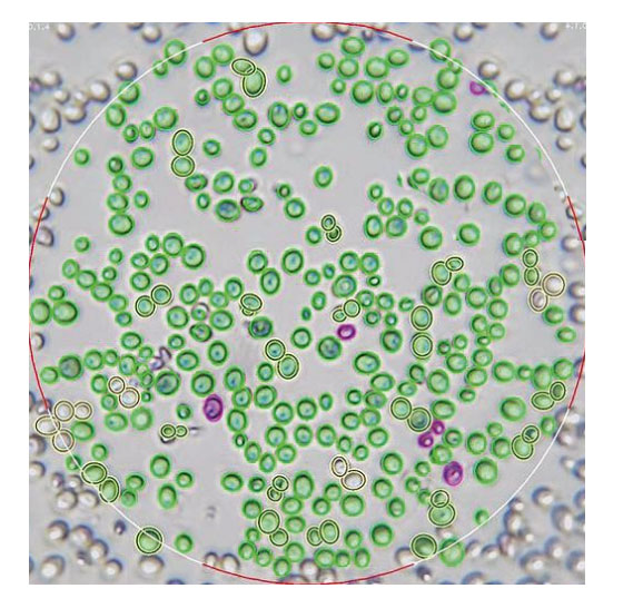 Yeast cells in an image evaluted by Oculyze Microscope