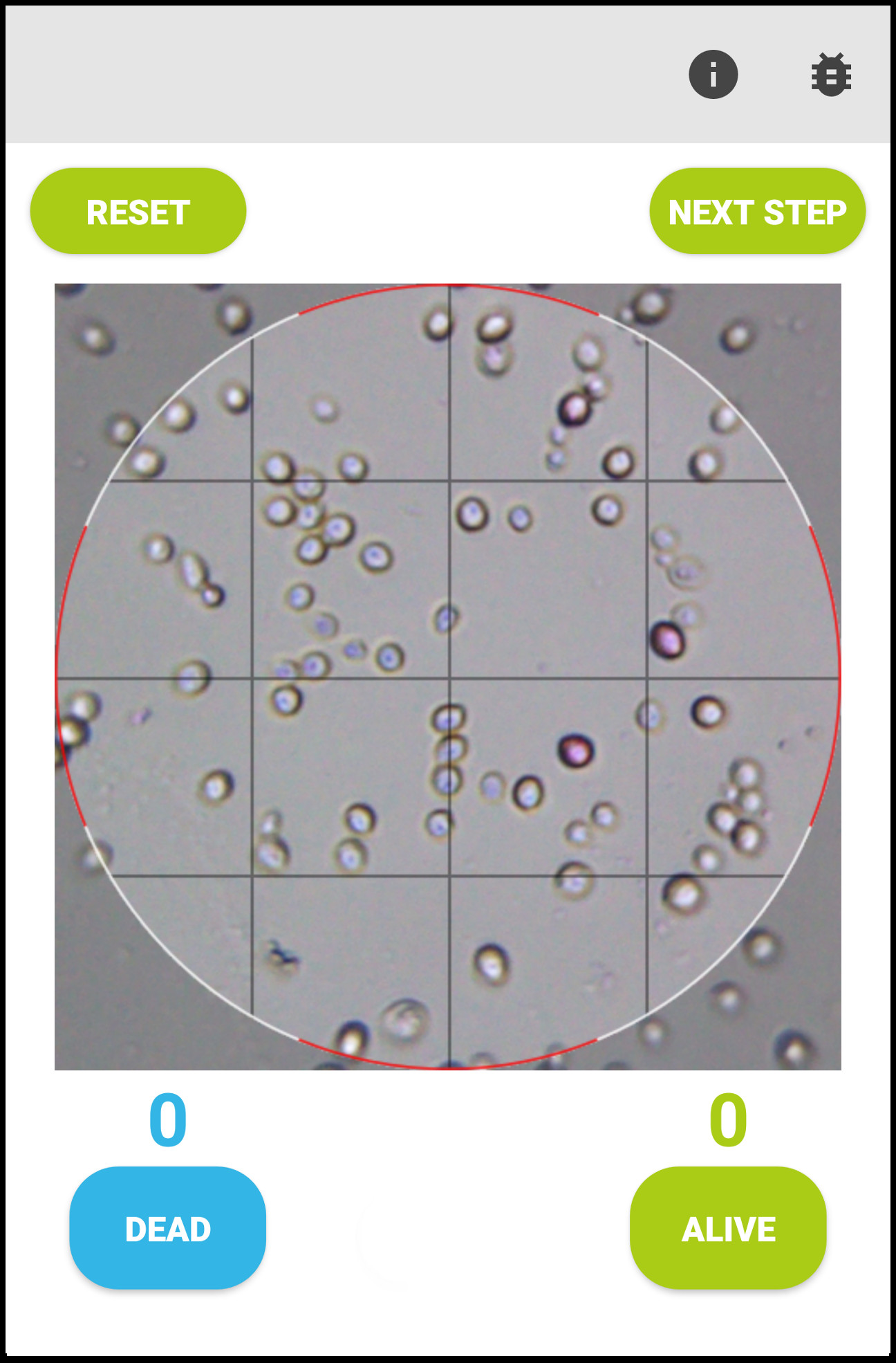 Manual counting of the yeast cells Oculyze