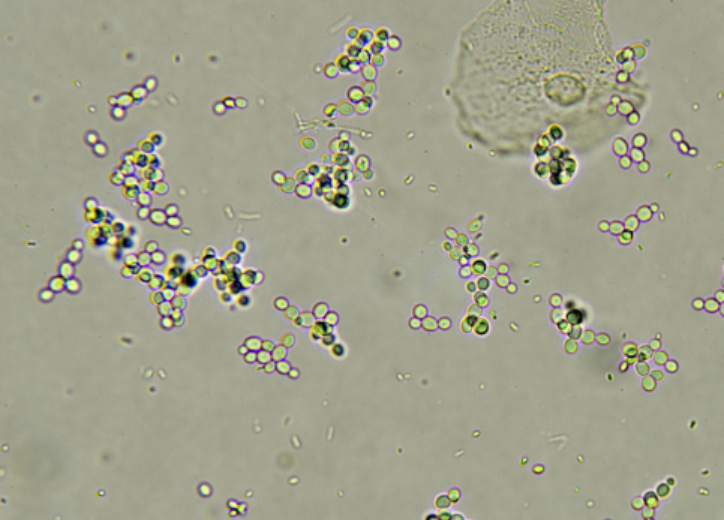 Automated Yeast Cell Counters - Microscopic yeast sample image