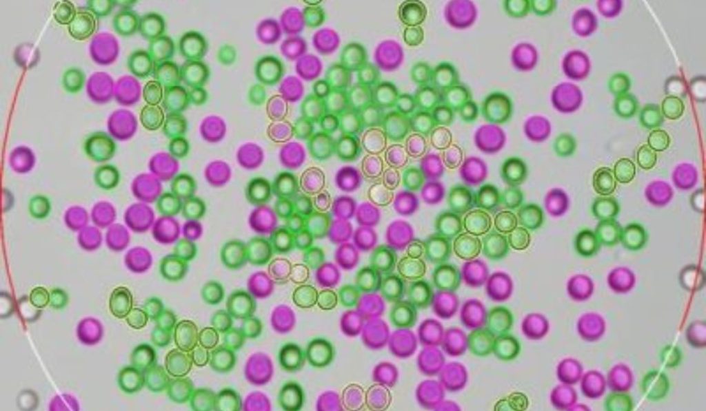 Rapid Determination of Yeast Viability How and Why