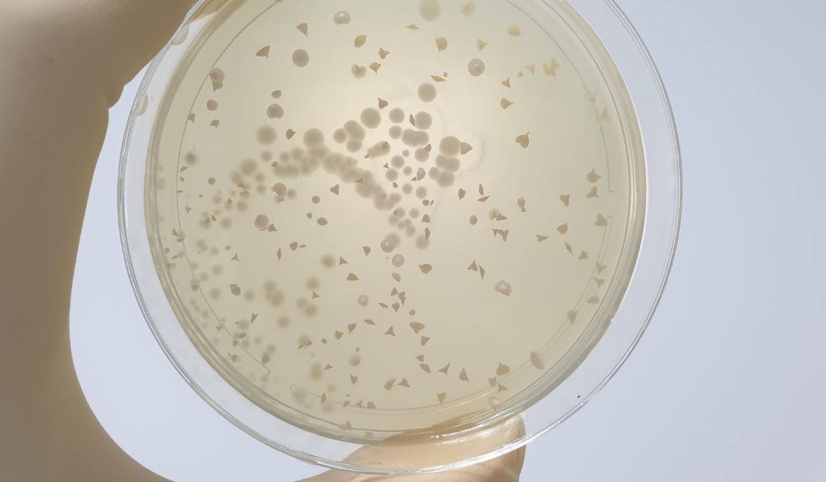 Multiplying Yeast What Is Yeast Propagation?