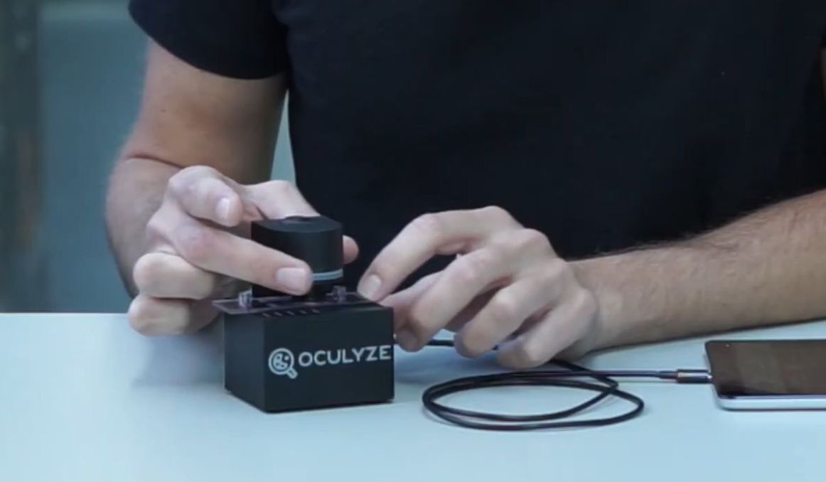 The Best Microscope for Yeast Counting