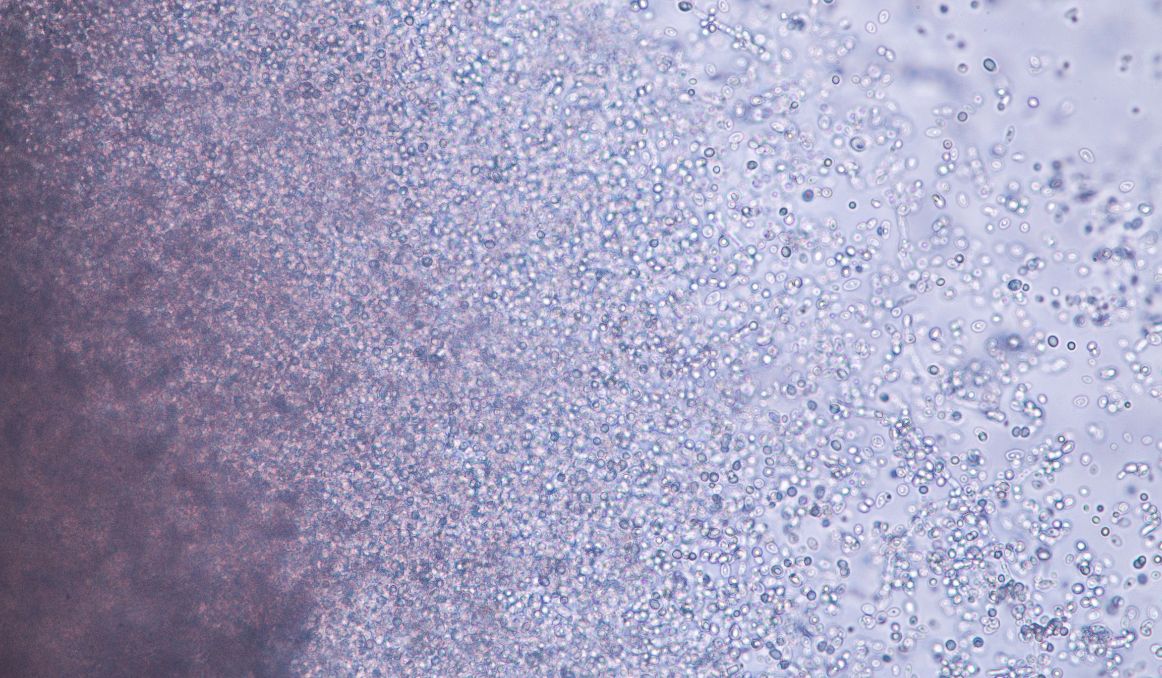 What Does Alive Yeast Look Like?