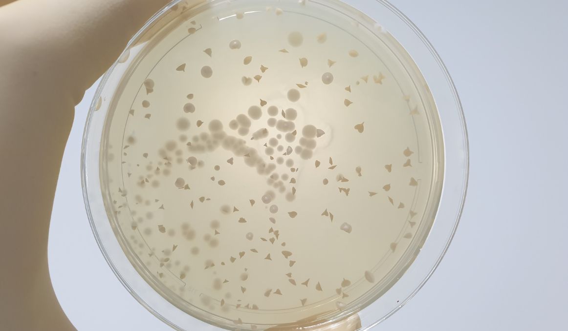 Keeping Beer Yeast Alive Your Need to Know