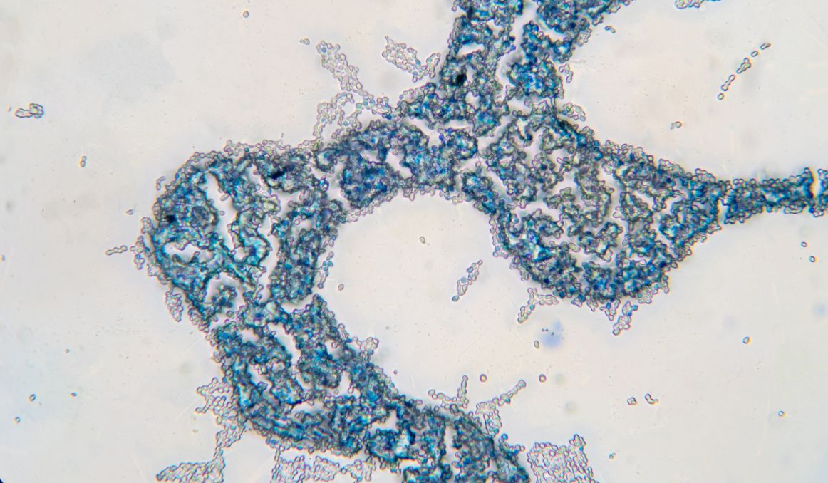 Keeping Beer Yeast Alive Your Need to Know