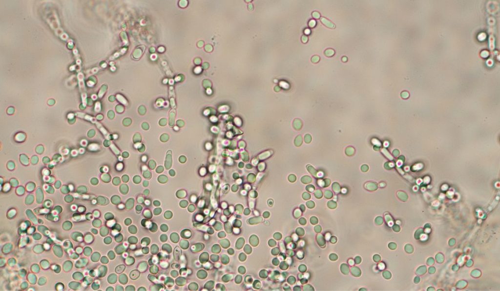 What Does Yeast Need to Reproduce