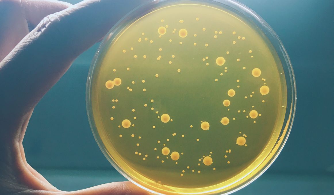 Common Beer Spoilage Bacteria common-beer-spoilage-bacteria