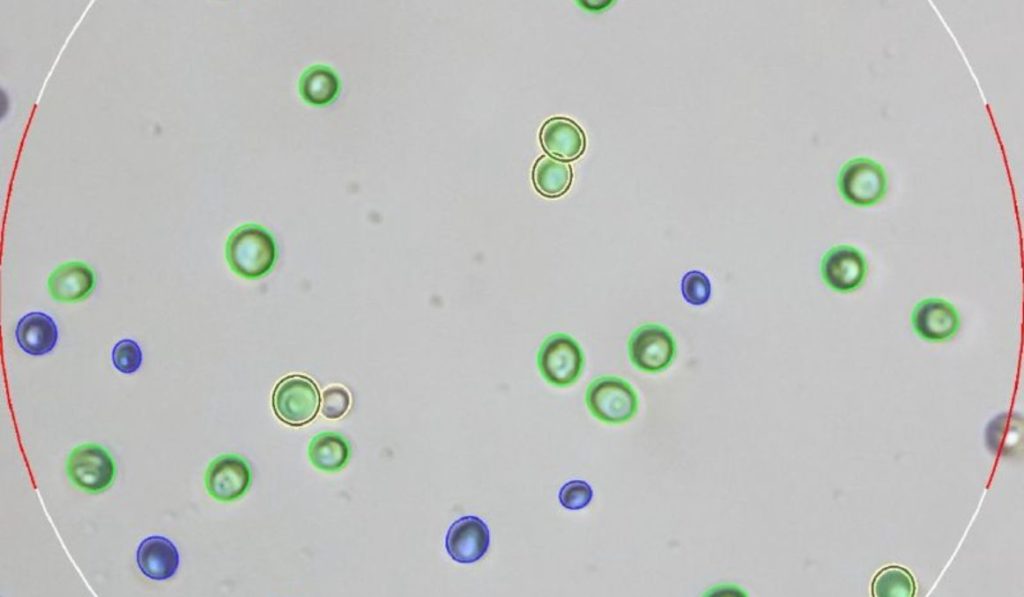 How to know if your yeast is alive