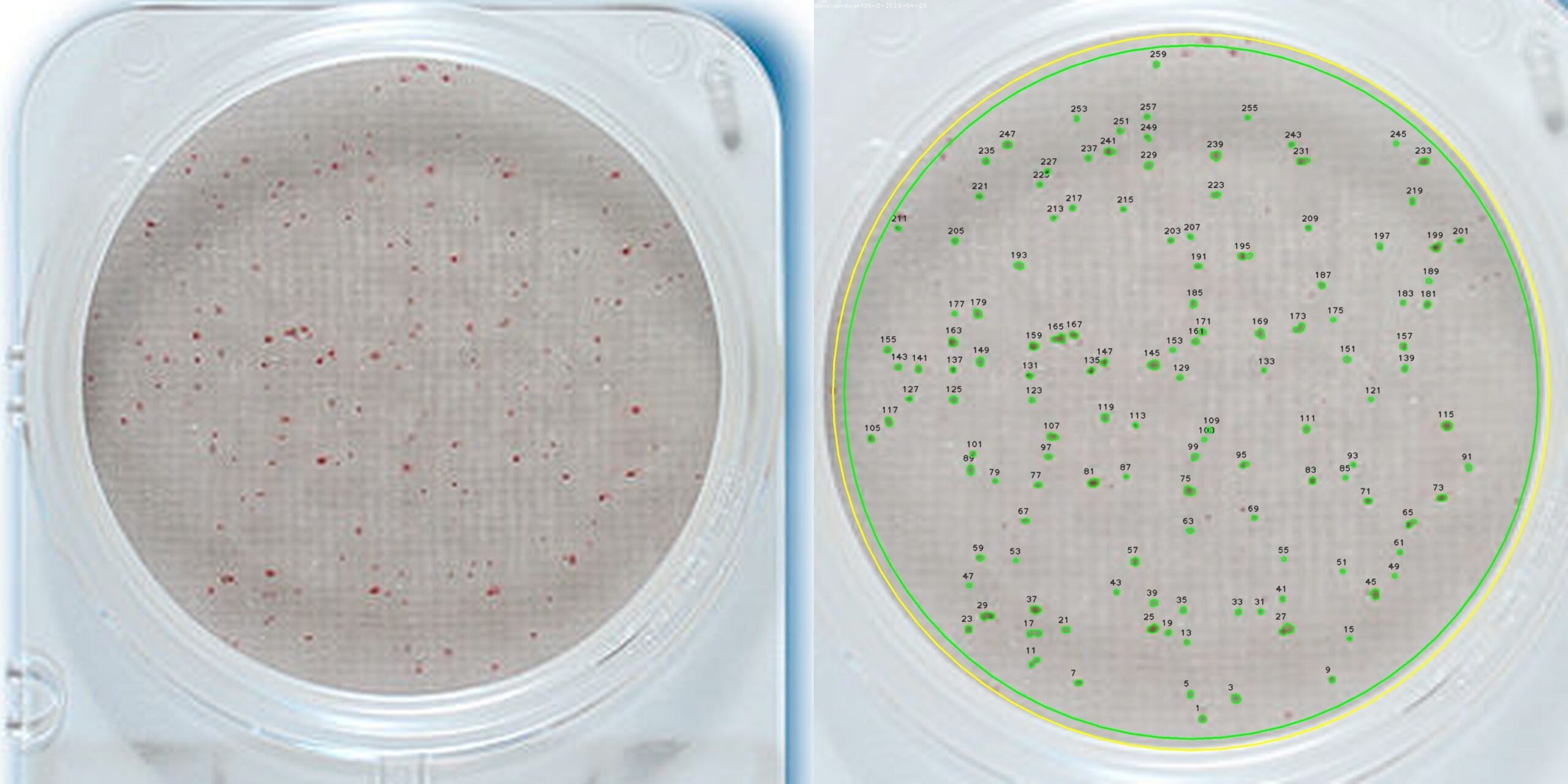 How to Measure Bacteria in a Petri Dish