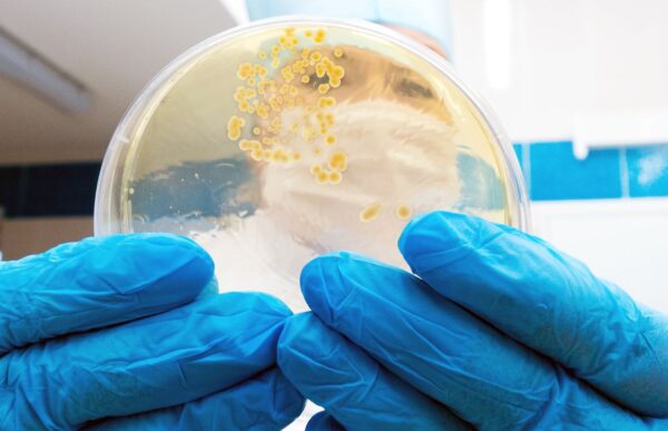 CFU Calculation Formula