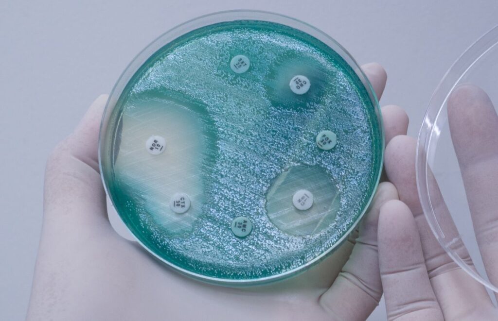 How to Measure Kirby Bauer Test Instructions