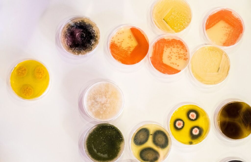 Identifying Bacteria In Petri Dishes identifying-bacteria-in-petri-dishes