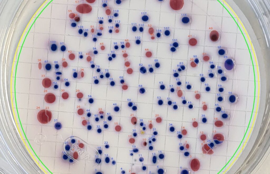 Petri Dish Bacteria Identification Chart Why Use One
